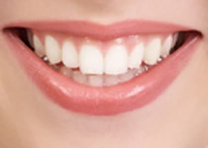 white teeth 4